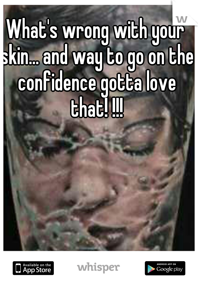 What's wrong with your skin... and way to go on the confidence gotta love that! !!!