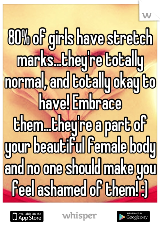 80% of girls have stretch marks...they're totally normal, and totally okay to have! Embrace them...they're a part of your beautiful female body and no one should make you feel ashamed of them! :)