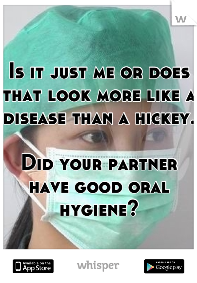 Is it just me or does that look more like a disease than a hickey. 

Did your partner have good oral hygiene?