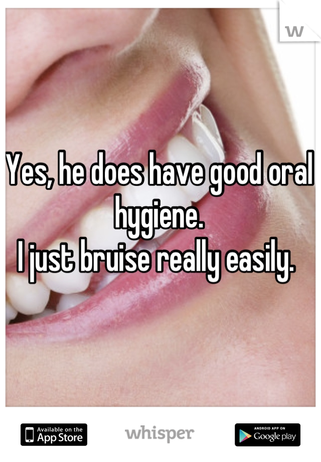 Yes, he does have good oral hygiene. 
I just bruise really easily. 
