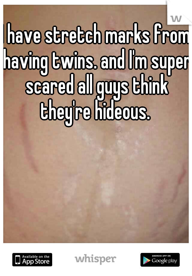 I have stretch marks from having twins. and I'm super scared all guys think they're hideous. 
