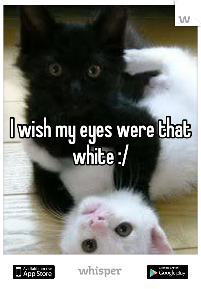 I wish my eyes were that white :/