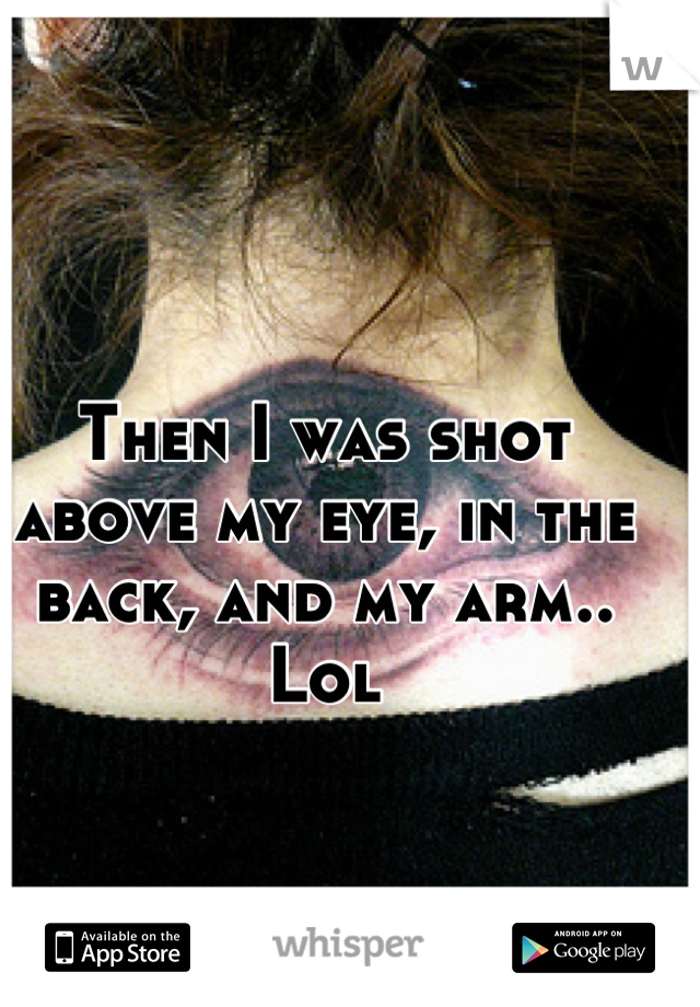 Then I was shot above my eye, in the back, and my arm.. Lol