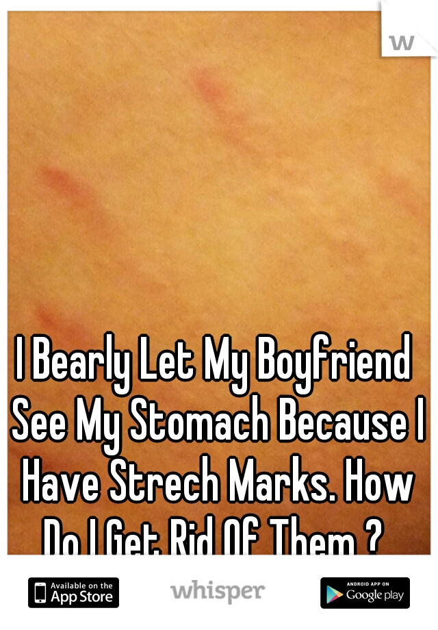 I Bearly Let My Boyfriend See My Stomach Because I Have Strech Marks. How Do I Get Rid Of Them ? 