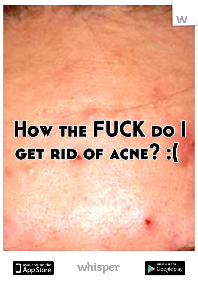 How the FUCK do I get rid of acne? :( 