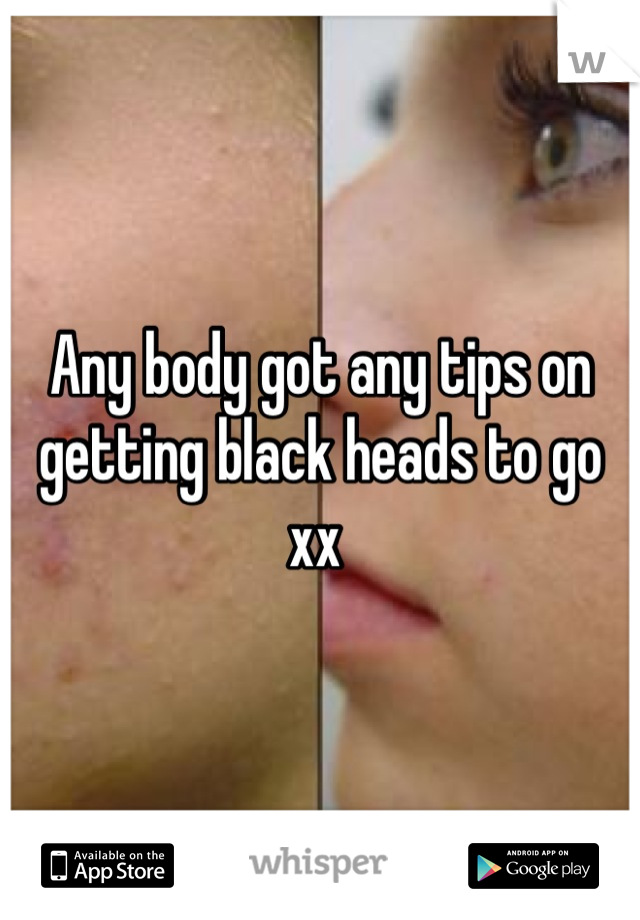 Any body got any tips on getting black heads to go xx 
