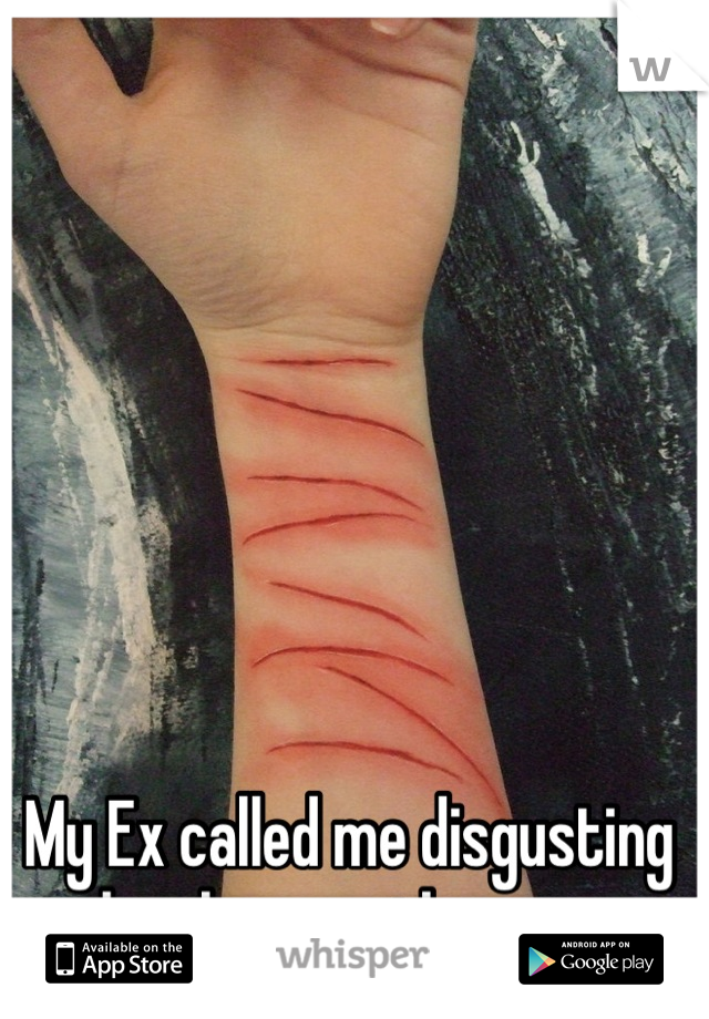 My Ex called me disgusting when he saw the scars.