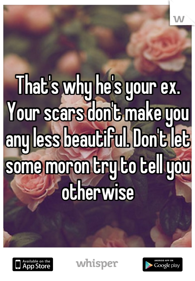 That's why he's your ex. Your scars don't make you any less beautiful. Don't let some moron try to tell you otherwise