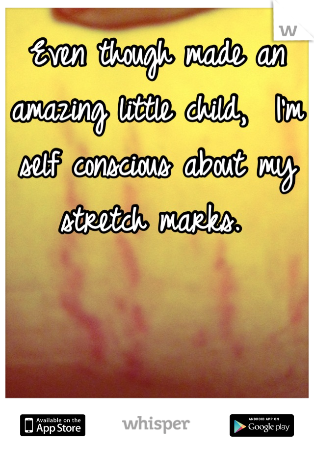 Even though made an amazing little child,  I'm self conscious about my stretch marks. 