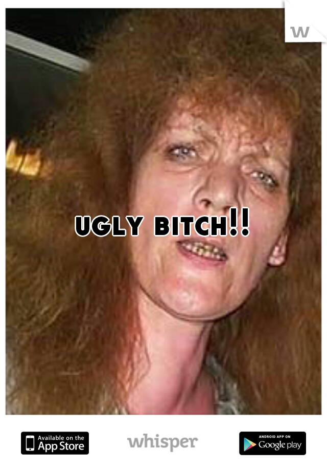 ugly bitch!!