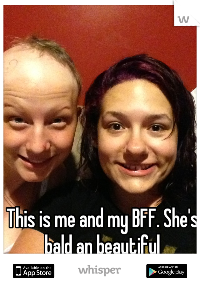 This is me and my BFF. She's bald an beautiful