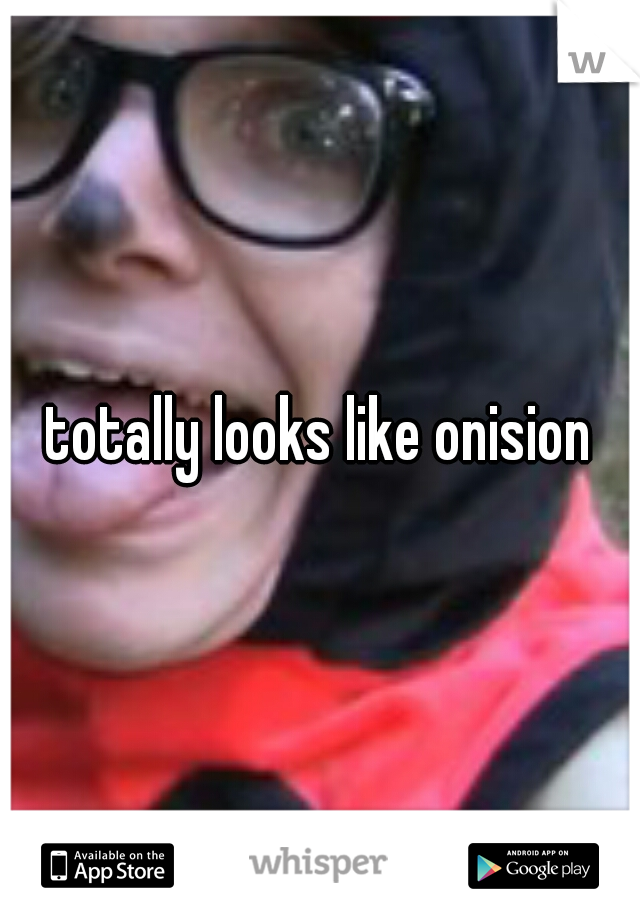 totally looks like onision