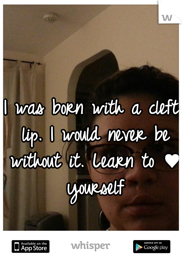 I was born with a cleft lip. I would never be without it. Learn to ♥ yourself