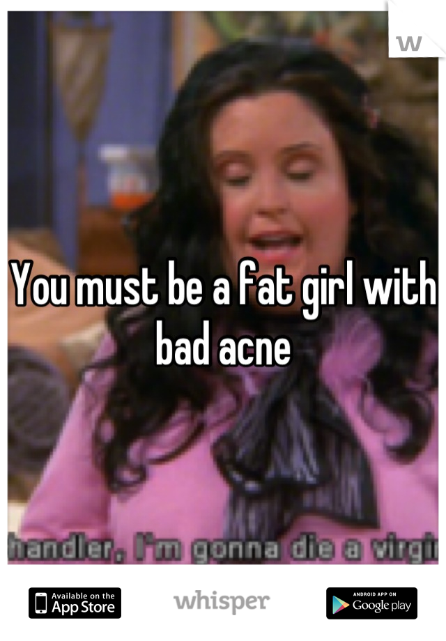 You must be a fat girl with bad acne