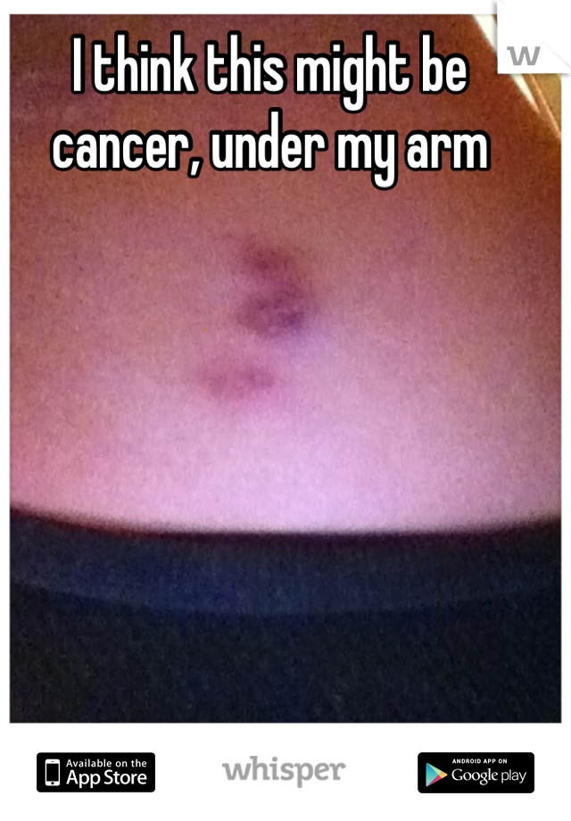 I think this might be cancer, under my arm