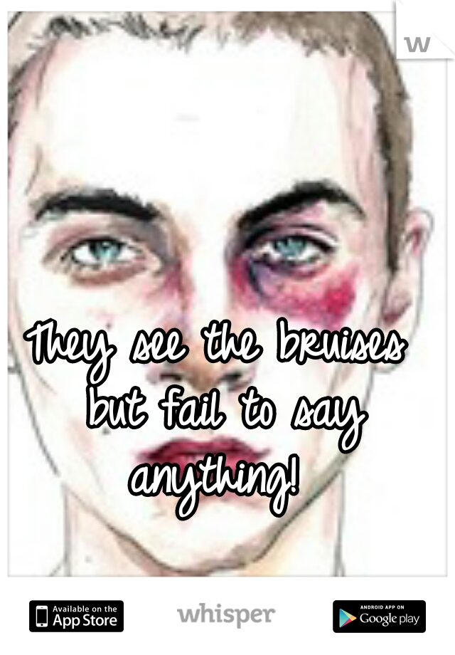 They see the bruises but fail to say anything! 