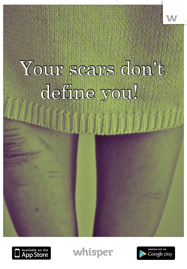 Your scars don't define you! 