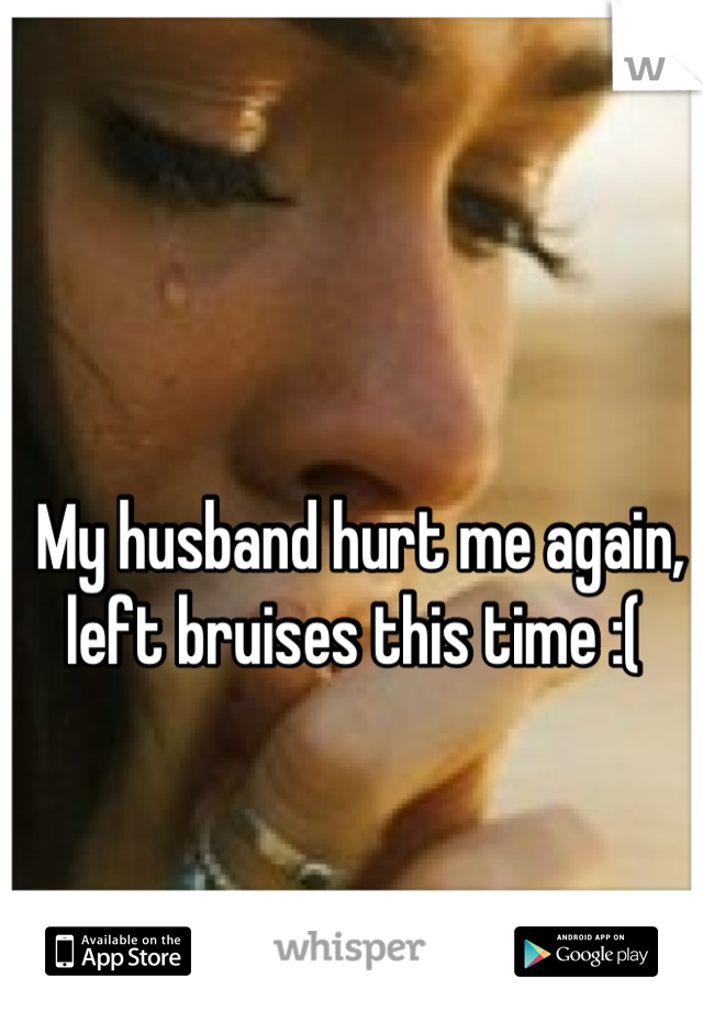 My husband hurt me again, left bruises this time :( 