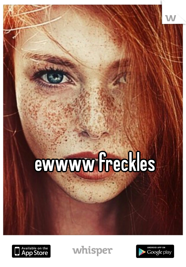 ewwww freckles