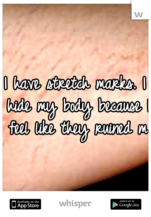 I have stretch marks. I hide my body because I feel like they ruined me