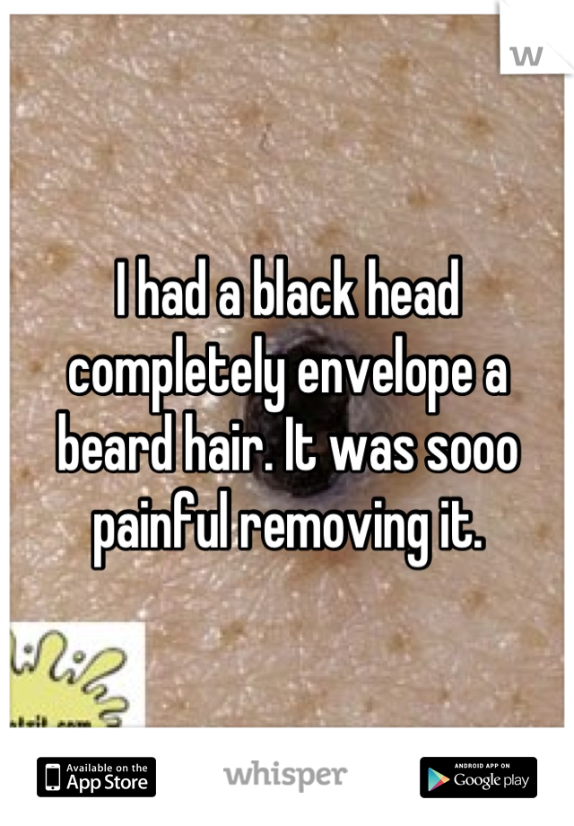 I had a black head completely envelope a beard hair. It was sooo painful removing it.