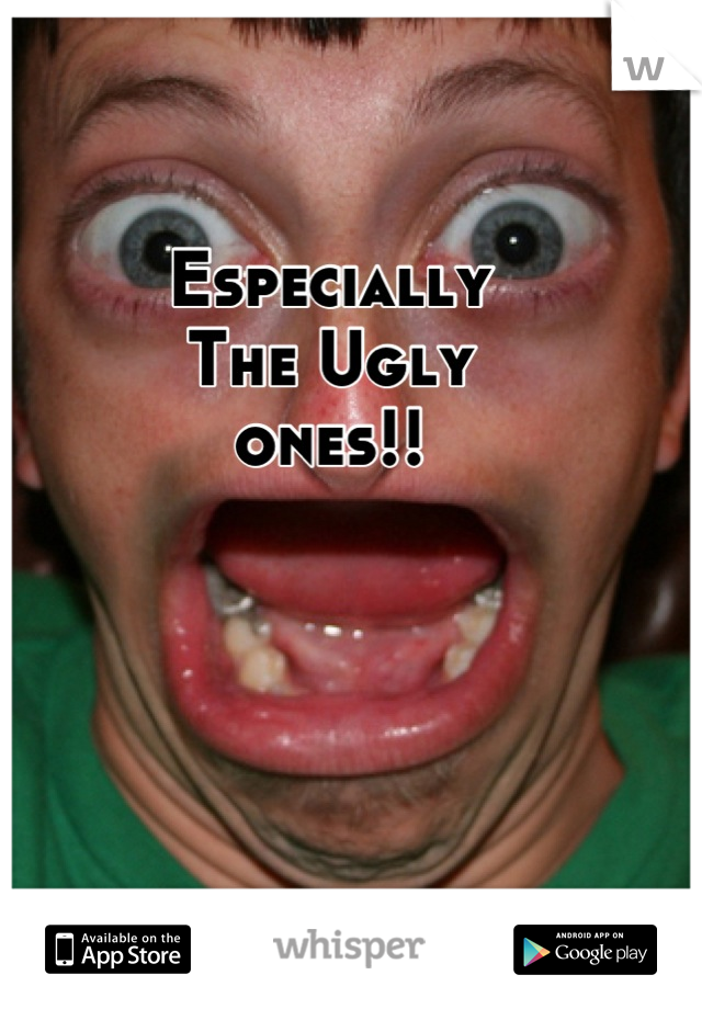 Especially
The Ugly
ones!!