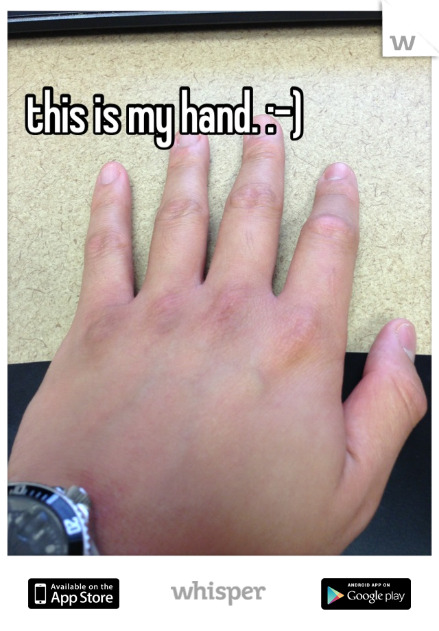 this is my hand. :-)