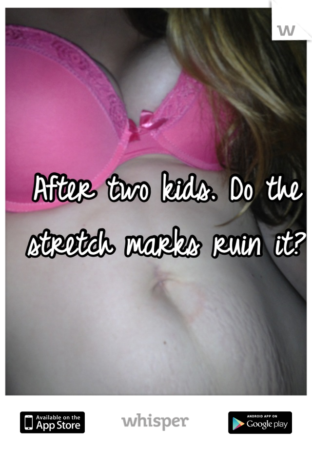After two kids. Do the stretch marks ruin it?