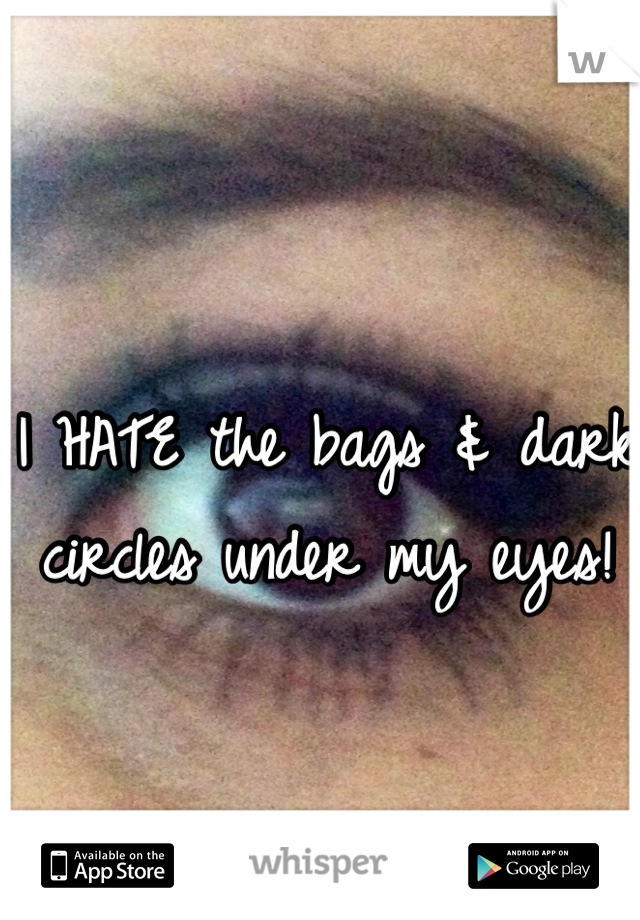 I HATE the bags & dark circles under my eyes!