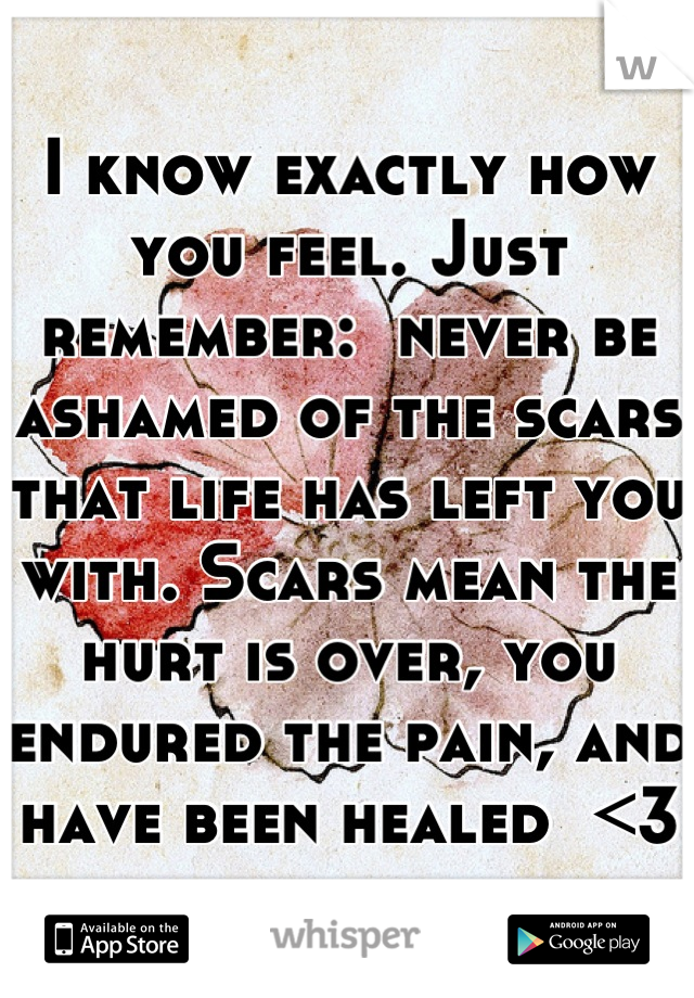 I know exactly how you feel. Just remember:  never be ashamed of the scars that life has left you with. Scars mean the hurt is over, you endured the pain, and have been healed  <3
