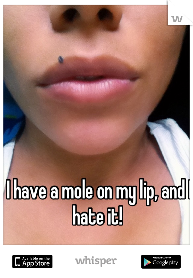 I have a mole on my lip, and I hate it! 