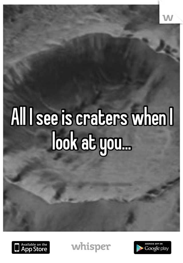 All I see is craters when I look at you...