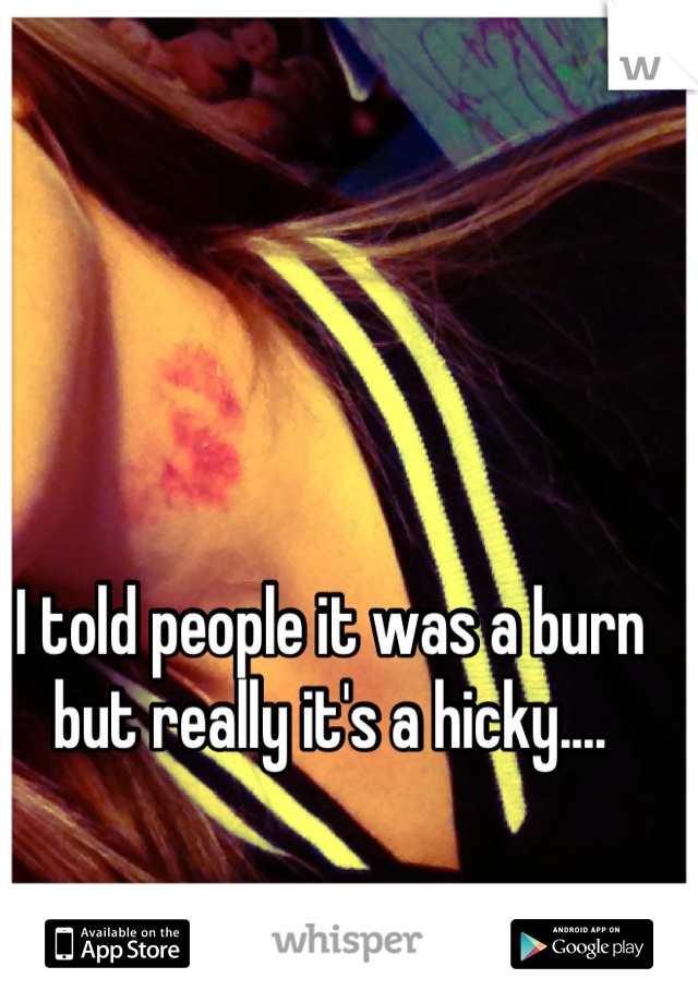 I told people it was a burn but really it's a hicky....