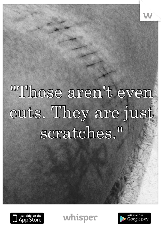"Those aren't even cuts. They are just scratches."