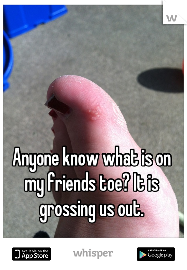 Anyone know what is on my friends toe? It is grossing us out.