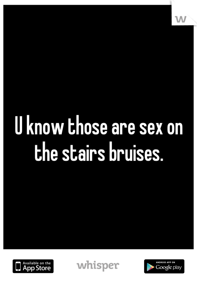 U know those are sex on the stairs bruises.