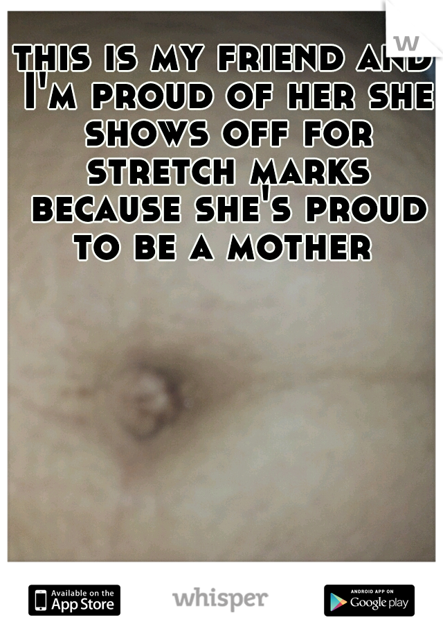 this is my friend and I'm proud of her she shows off for stretch marks because she's proud to be a mother 