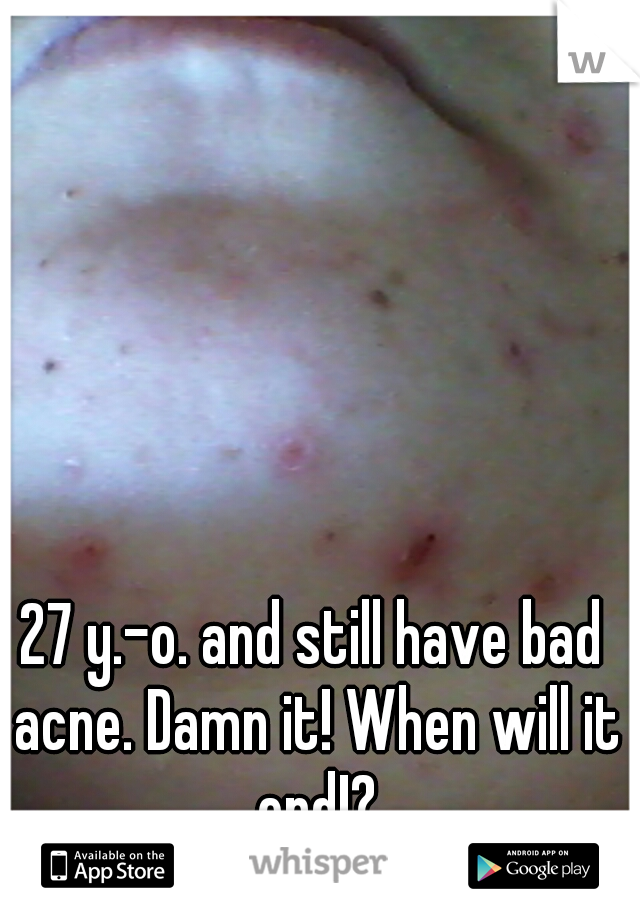 27 y.-o. and still have bad acne. Damn it! When will it end!?