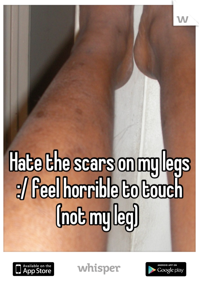 Hate the scars on my legs :/ feel horrible to touch  (not my leg) 