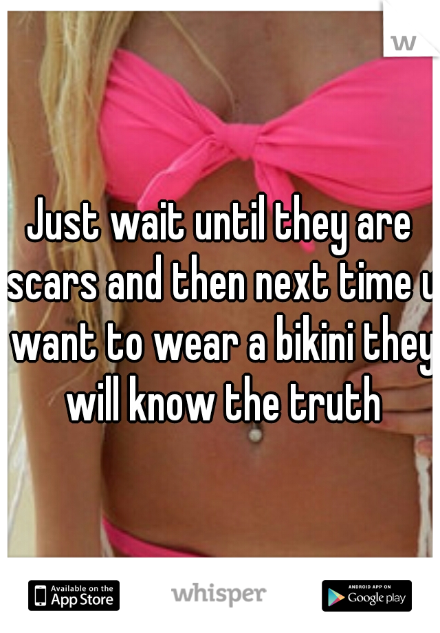 Just wait until they are scars and then next time u want to wear a bikini they will know the truth