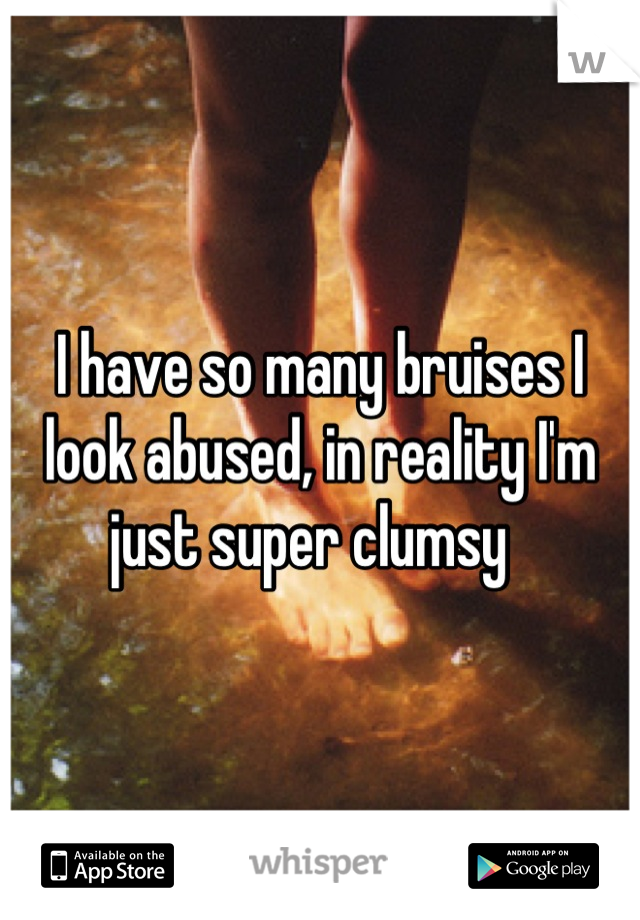 I have so many bruises I look abused, in reality I'm just super clumsy  