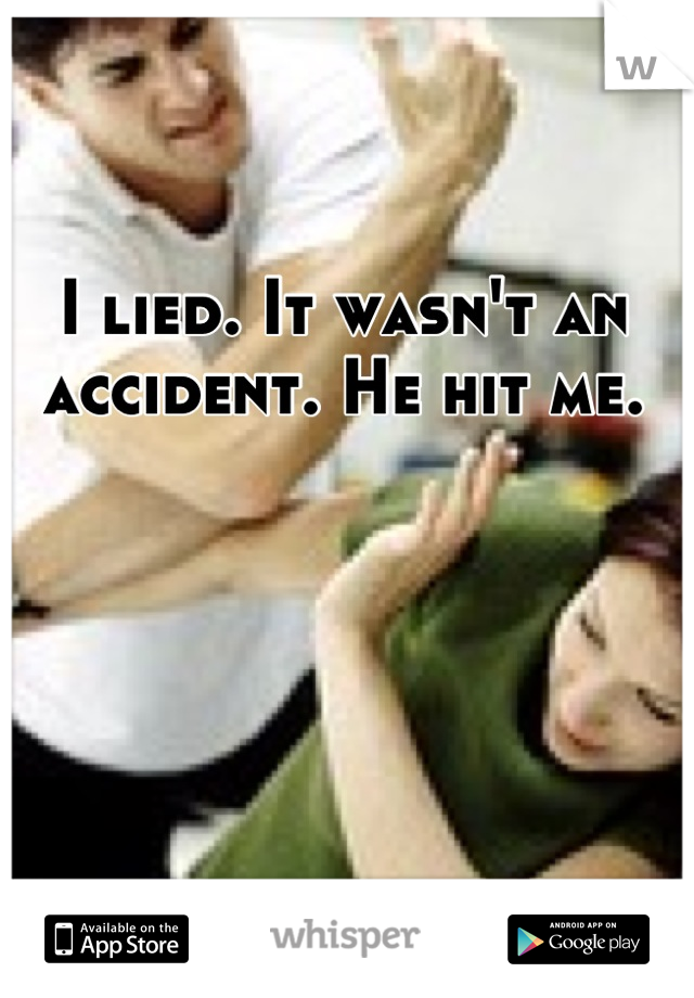 I lied. It wasn't an accident. He hit me.