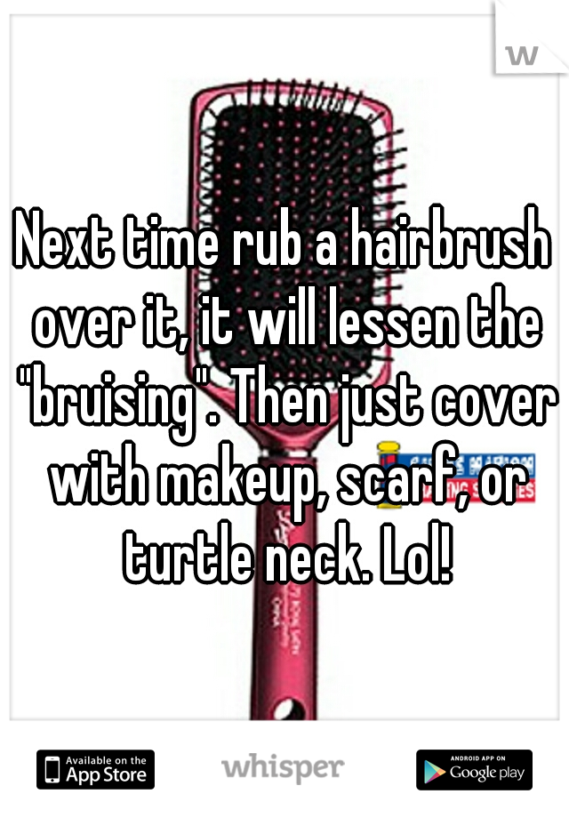 Next time rub a hairbrush over it, it will lessen the "bruising". Then just cover with makeup, scarf, or turtle neck. Lol!