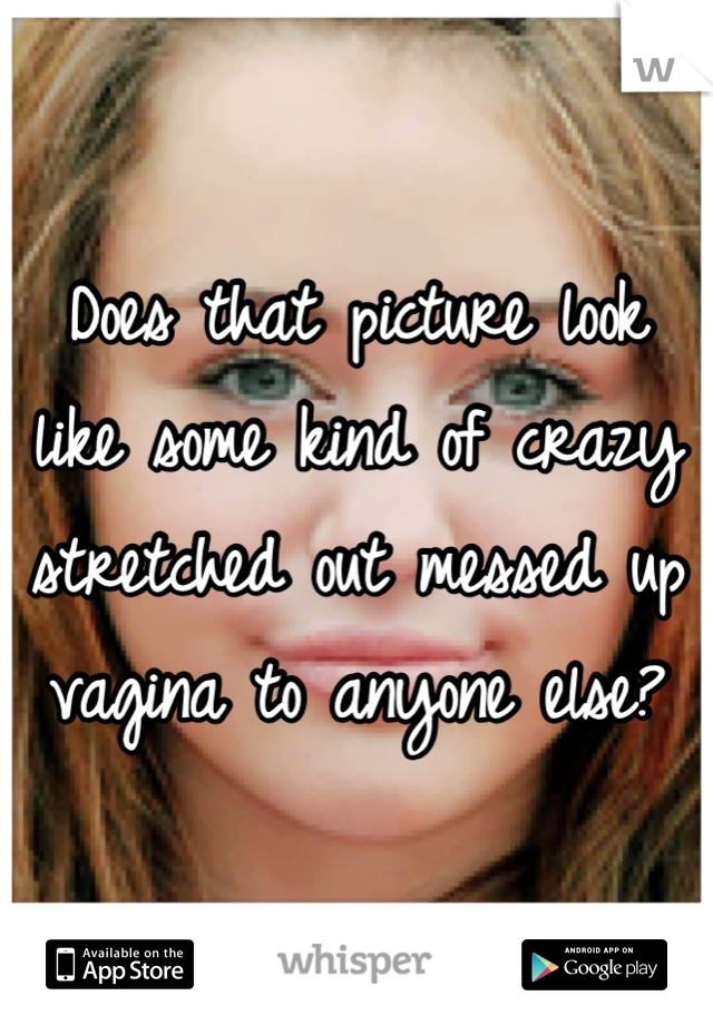 Does that picture look like some kind of crazy stretched out messed up vagina to anyone else?