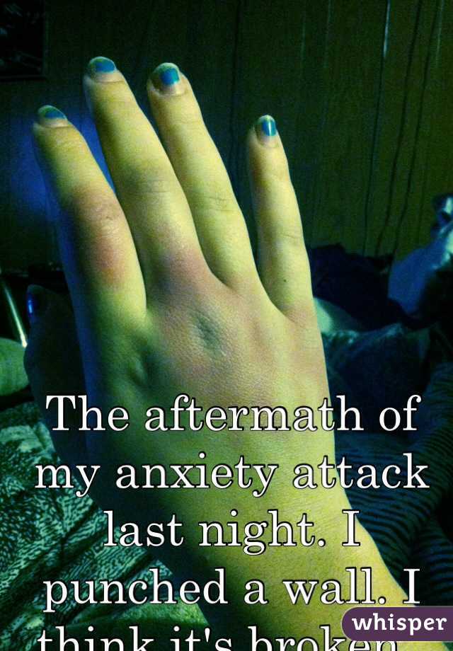 The aftermath of my anxiety attack last night. I punched a wall. I think it's broken..