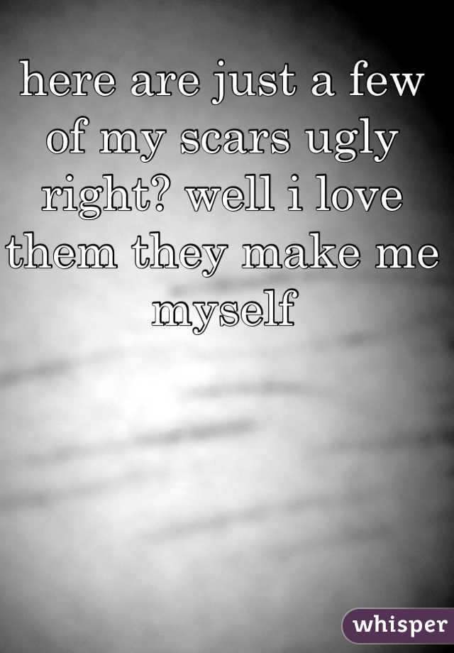 here are just a few of my scars ugly right? well i love them they make me myself 