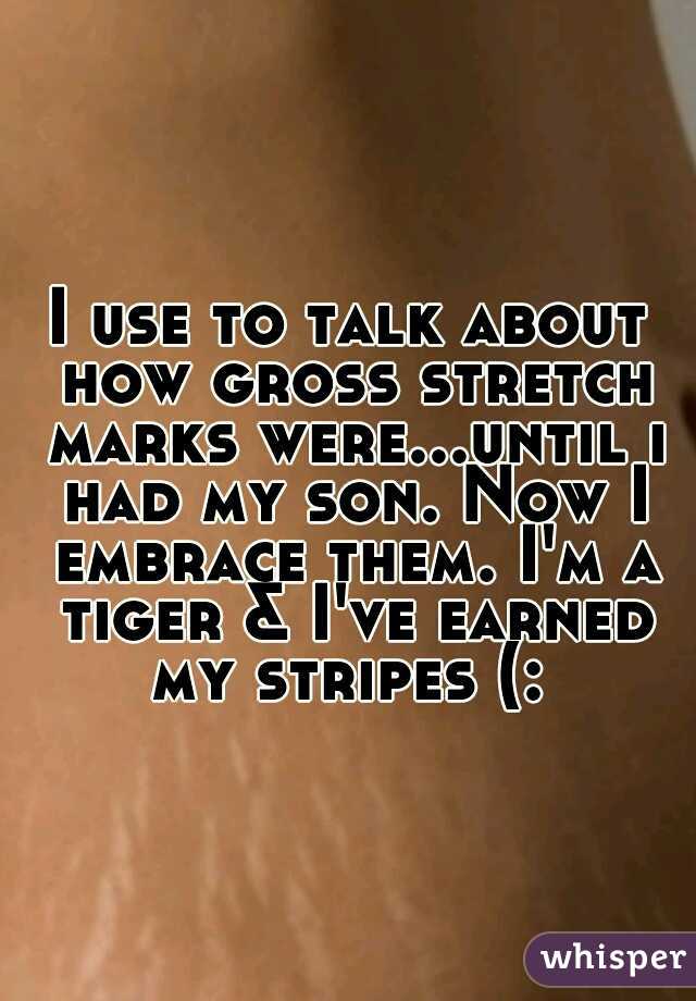I use to talk about how gross stretch marks were...until i had my son. Now I embrace them. I'm a tiger & I've earned my stripes (: 