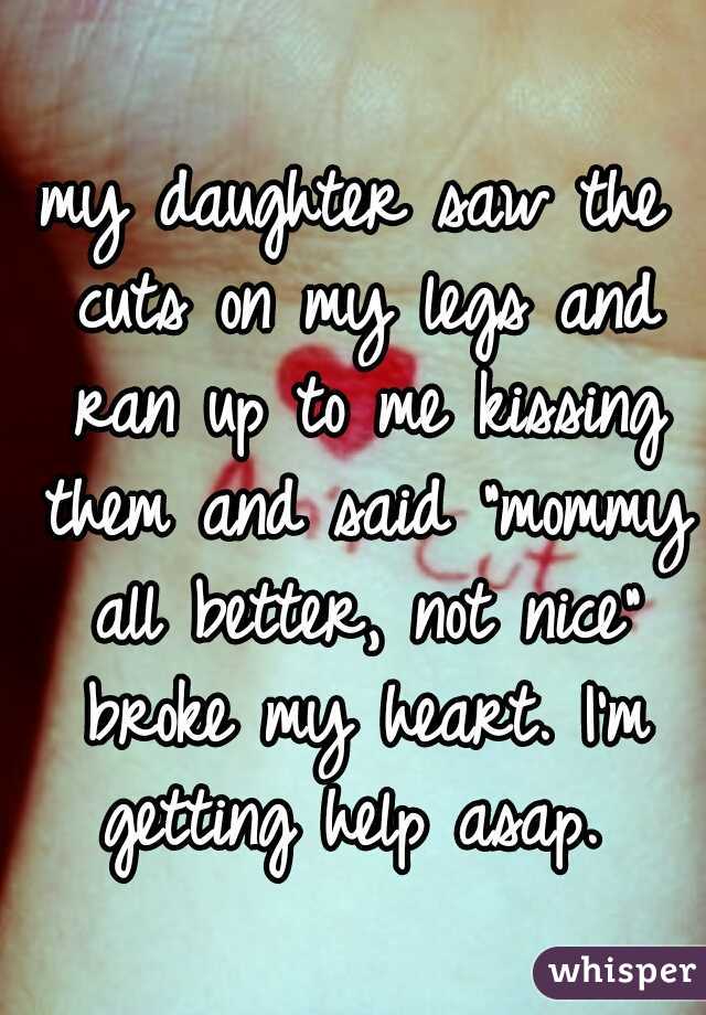 my daughter saw the cuts on my legs and ran up to me kissing them and said "mommy all better, not nice" broke my heart. I'm getting help asap. 