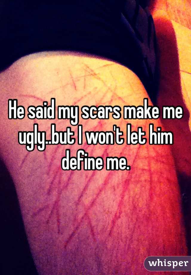 He said my scars make me ugly..but I won't let him define me.