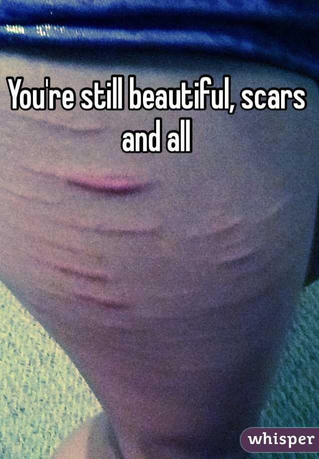 You're still beautiful, scars and all
